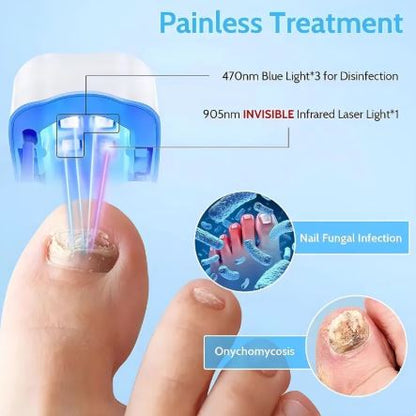 Advanced Nail Fungus Laser Treatment Device