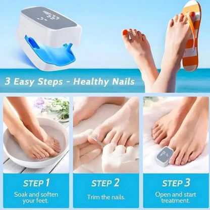 Advanced Nail Fungus Laser Treatment Device
